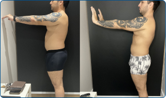Gabriel - Antes e Depois