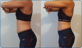Karla - Antes e Depois